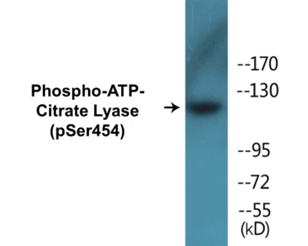 ATP-Citrate Lyase (phospho Ser454) Cell Based ELISA Kit (A102068-296)