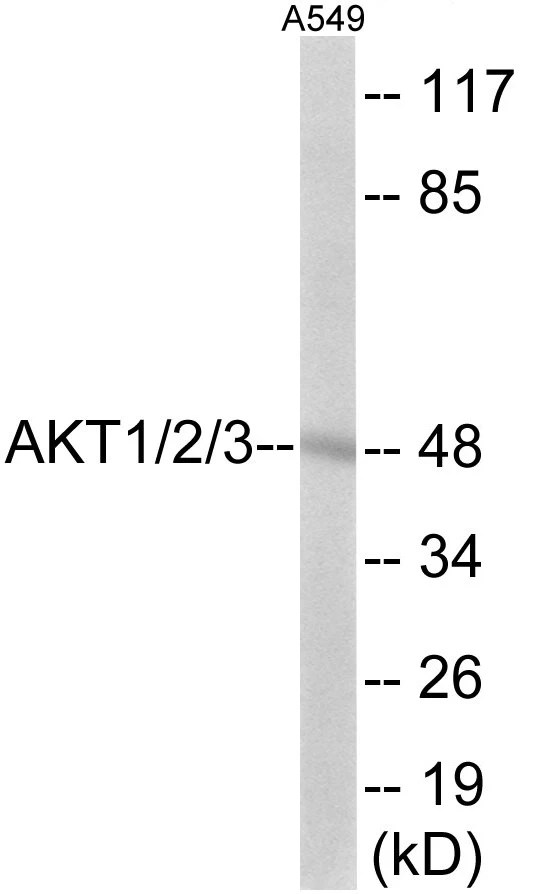 AKT1 + 2 + 3 Cell Based ELISA Kit (A102851-96)