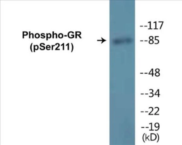 GR (phospho Ser211) Cell Based ELISA Kit (A102474-296)