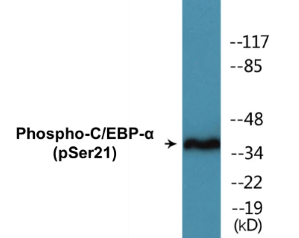 CEBP alpha (phospho Ser21) Cell Based ELISA Kit (A102534-296)