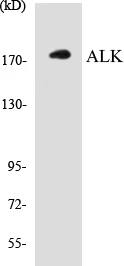 ALK Cell Based ELISA Kit (A103562-96)