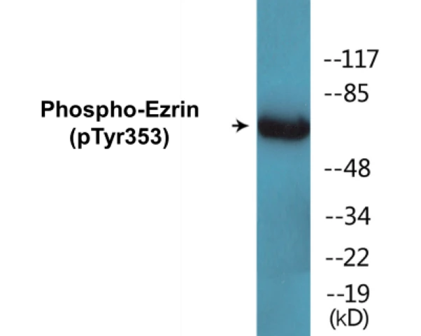 Ezrin (phospho Tyr353) Cell Based ELISA Kit (A102160-296)