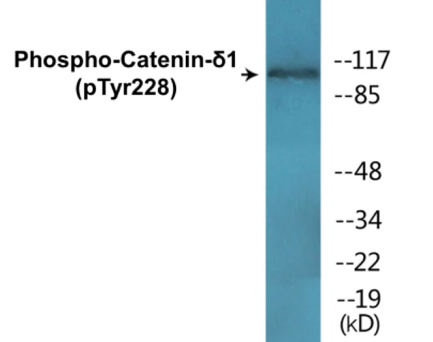 Catenin delta 1 (phospho Tyr228) Cell Based ELISA Kit (A102241-296)