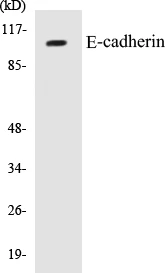 E-cadherin Cell Based ELISA Kit (A103623-96)