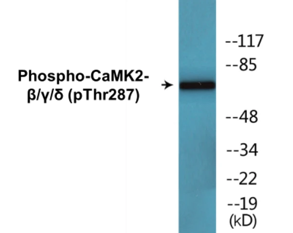 CaMK2 beta gamma delta (phospho Thr287) Cell Based ELISA Kit (A102228-296)