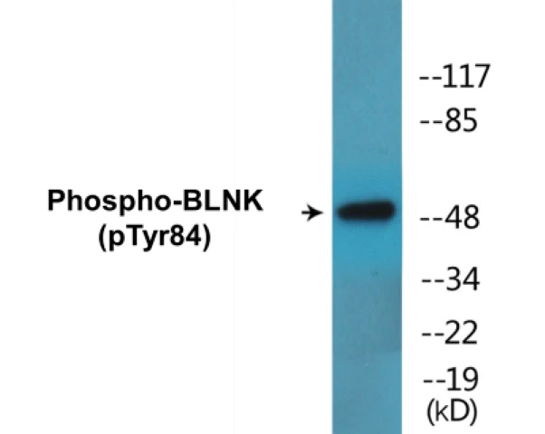 BLNK (phospho Tyr84) Cell Based ELISA Kit (A102451-296)