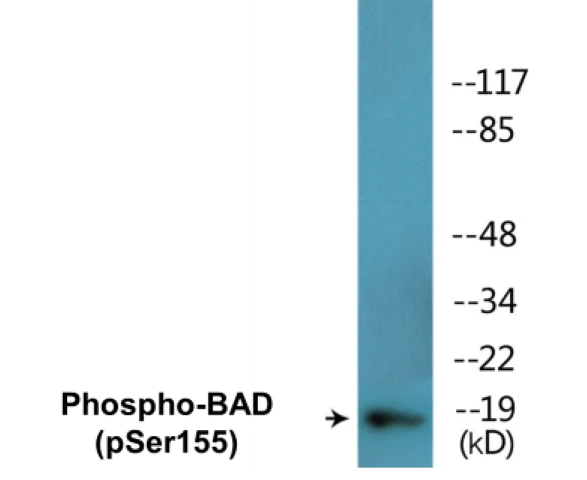 BAD (phospho Ser155) Cell Based ELISA Kit (A102436-296)