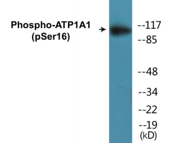 ATP1A1 (phospho Ser16) Cell Based ELISA Kit (A102142-296)