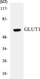 GLUT1 Cell Based ELISA Kit (A103098-96)