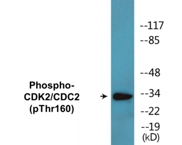 CDK2 (phospho Thr160) Cell Based ELISA Kit (A102271-296)