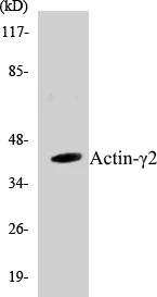 Actin gamma 2 Cell Based ELISA Kit (A102841-96)