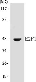 E2F1 Cell Based ELISA Kit (A103521-96)