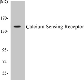 Calcium Sensing Receptor Cell Based ELISA Kit (A102794-96)