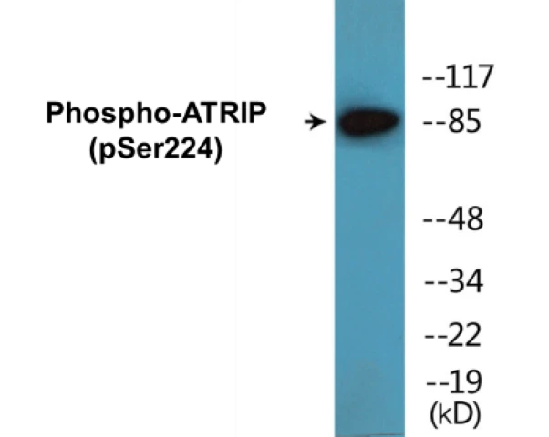 ATRIP (phospho Ser224) Cell Based ELISA Kit (A102726-296)