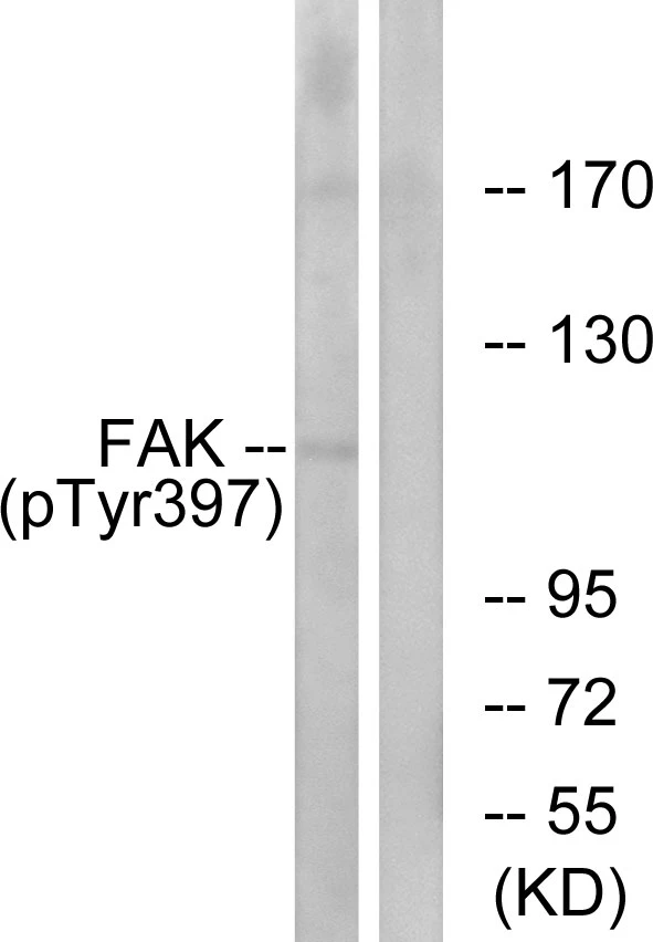 FAK (phospho Tyr397) Cell Based ELISA Kit (A103823-296)