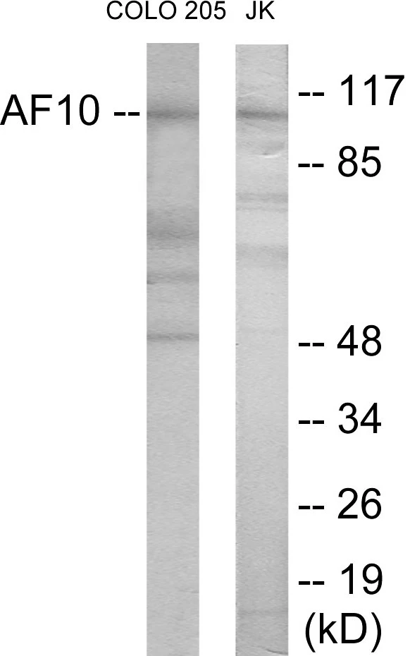 AF10 Cell Based ELISA Kit (A103544-96)