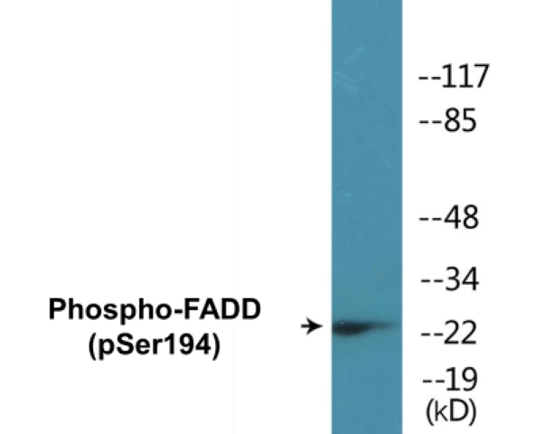 FADD (phospho Ser194) Cell Based ELISA Kit (A102730-296)