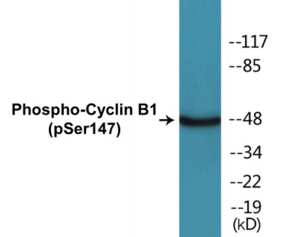 Cyclin B1 (phospho Ser147) Cell Based ELISA Kit (A102543-296)