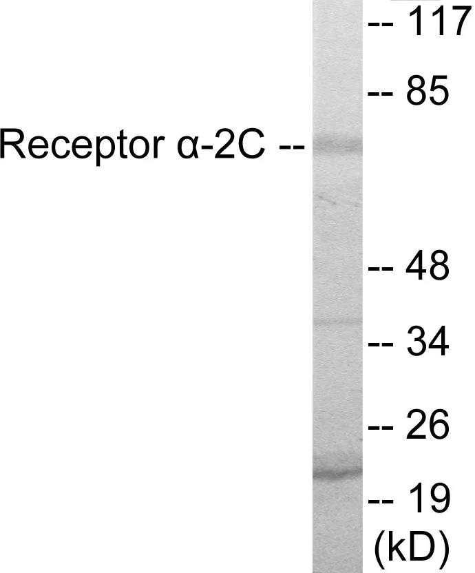 Adrenergic Receptor alpha 2C Cell Based ELISA Kit (A102817-96)