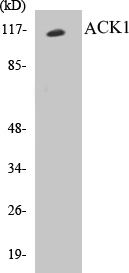 ACK1 Cell Based ELISA Kit (A103515-96)