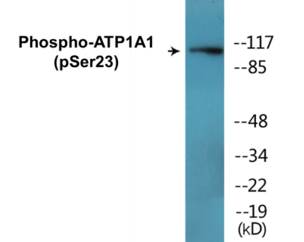 ATP1A1 (phospho Ser23) Cell Based ELISA Kit (A102792-296)