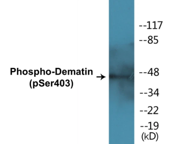 Dematin (phospho Ser403) Cell Based ELISA Kit (A102596-296)