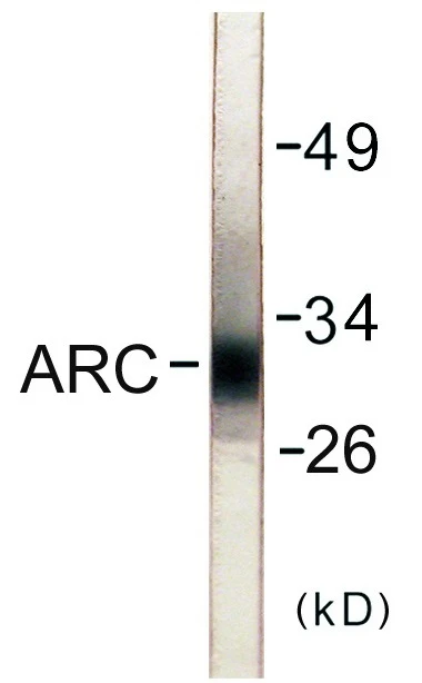 ARC Cell Based ELISA Kit (A103752-96)