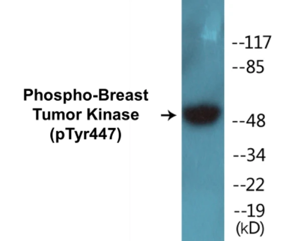 Breast Tumor Kinase (phospho Tyr447) Cell Based ELISA Kit (A102765-296)