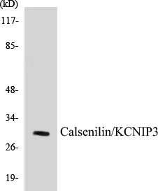 Calsenilin Cell Based ELISA Kit (A103377-96)