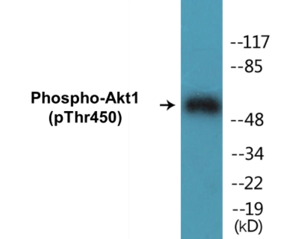 Akt1 (phospho Ser124) Cell Based ELISA Kit (A102291-296)