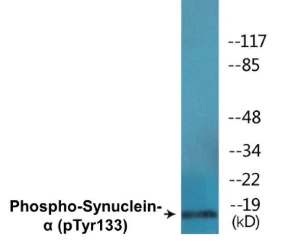 alpha Synuclein (phospho Tyr133) Cell Based ELISA Kit (A102244-296)