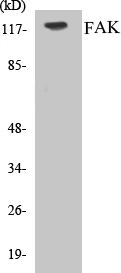 FAK Cell Based ELISA Kit (A103329-96)