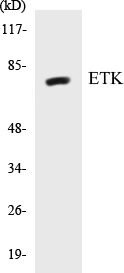 ETK Cell Based ELISA Kit (A103566-96)