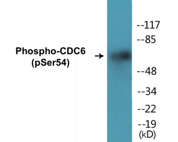 CDC6 (phospho Ser54) Cell Based ELISA Kit (A102668-296)