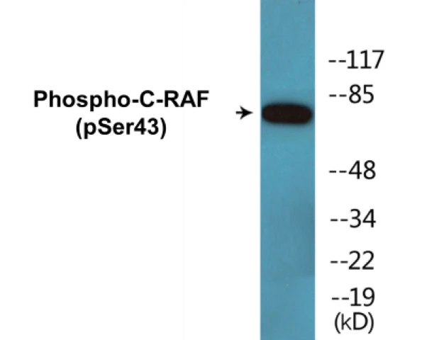 C-RAF (phospho Ser43) Cell Based ELISA Kit (A102311-296)