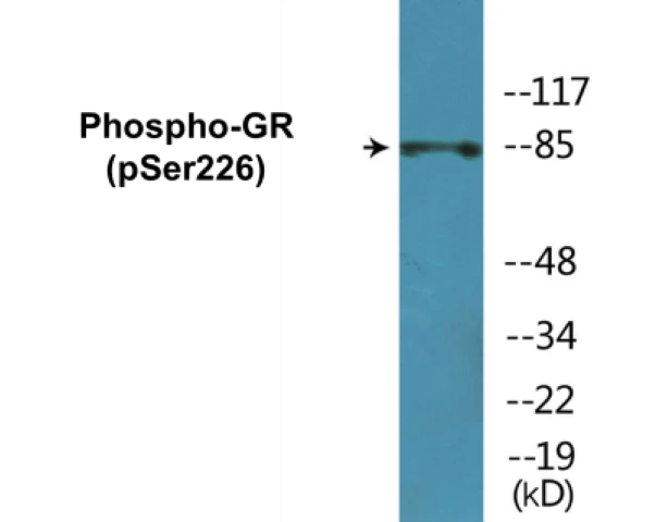 GR (phospho Ser226) Cell Based ELISA Kit (A102475-296)