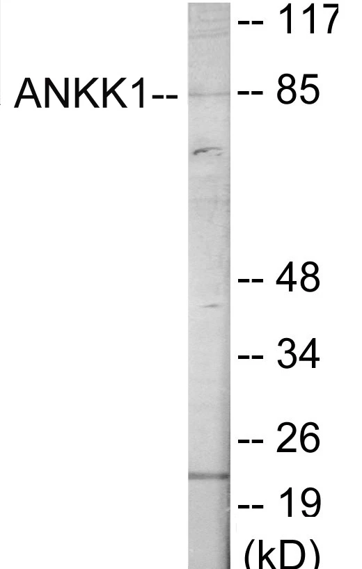 ANKK1 Cell Based ELISA Kit (A103705-96)