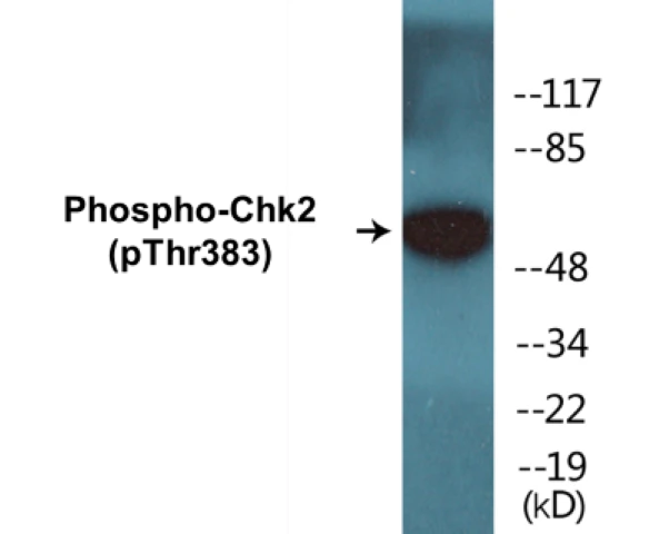 Chk2 (phospho Thr383) Cell Based ELISA Kit (A102304-296)