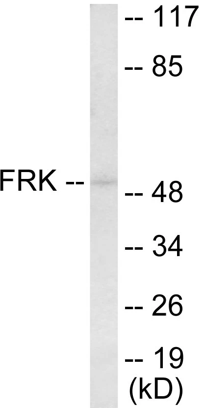 FRK Cell Based ELISA Kit (A103341-96)