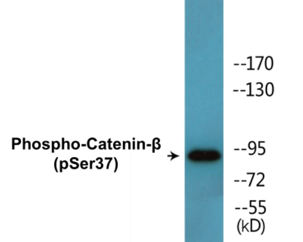 beta Catenin (phospho Ser37) Cell Based ELISA Kit (A102505-296)