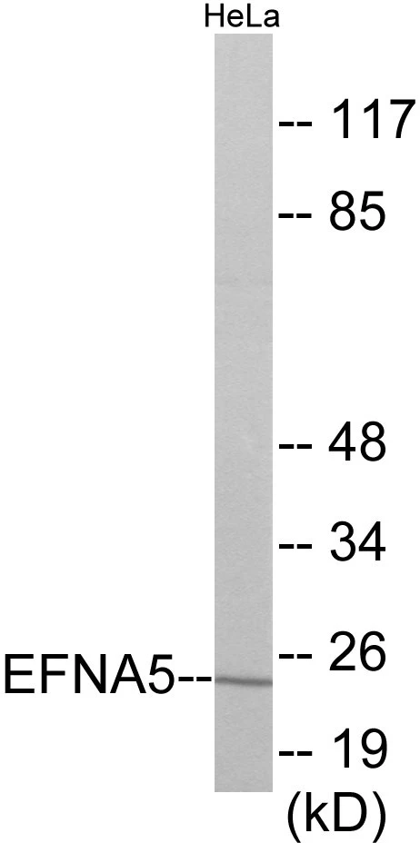 EFNA5 Cell Based ELISA Kit (A103153-96)