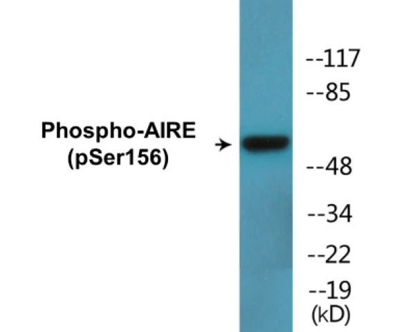 AIRE (phospho Ser156) Cell Based ELISA Kit (A102746-296)