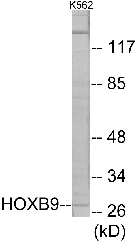 HOXB9 Cell Based ELISA Kit (A103431-96)