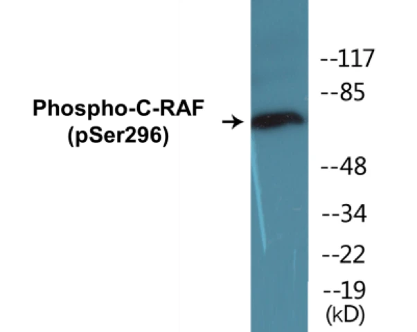 C-RAF (phospho Ser296) Cell Based ELISA Kit (A102154-296)