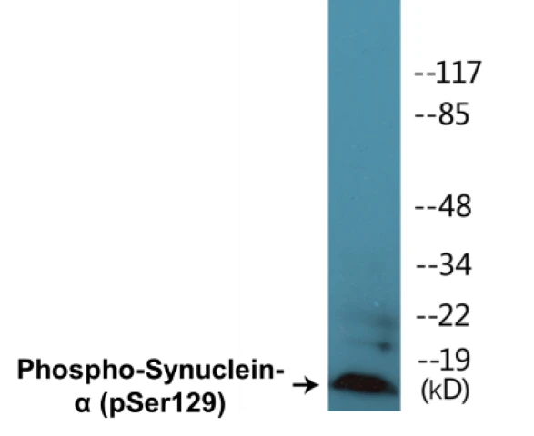 alpha Synuclein (phospho Ser129) Cell Based ELISA Kit (A102235-296)