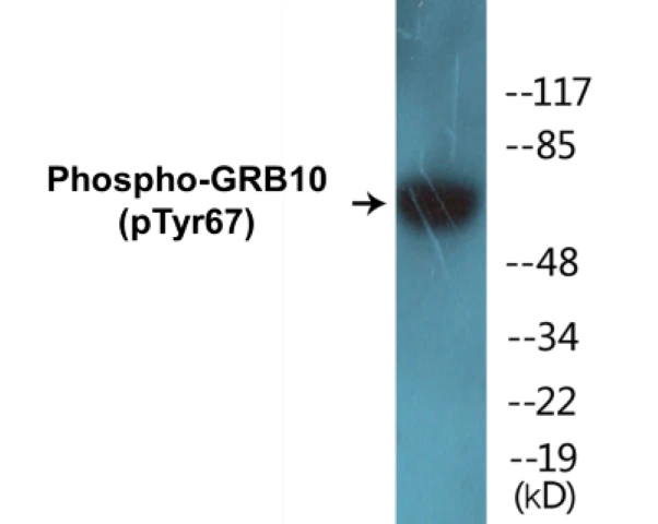 GRB10 (phospho Tyr67) Cell Based ELISA Kit (A102737-296)