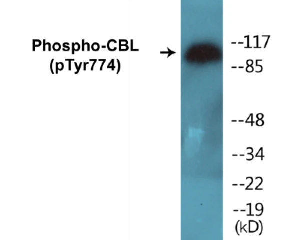 CBL (phospho Tyr774) Cell Based ELISA Kit (A102418-296)