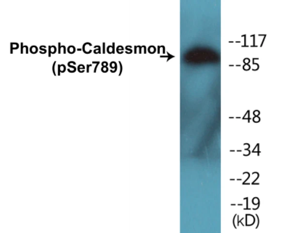 Caldesmon (phospho Ser789) Cell Based ELISA Kit (A102541-296)