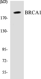 BRCA1 Cell Based ELISA Kit (A103671-96)