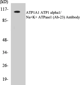 ATP1A1 Cell Based ELISA Kit (A102991-96)